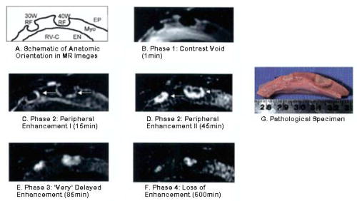 An external file that holds a picture, illustration, etc., usually as some form of binary object. The name of referred object is rmmj-1-2_e0015_Figure06.jpg